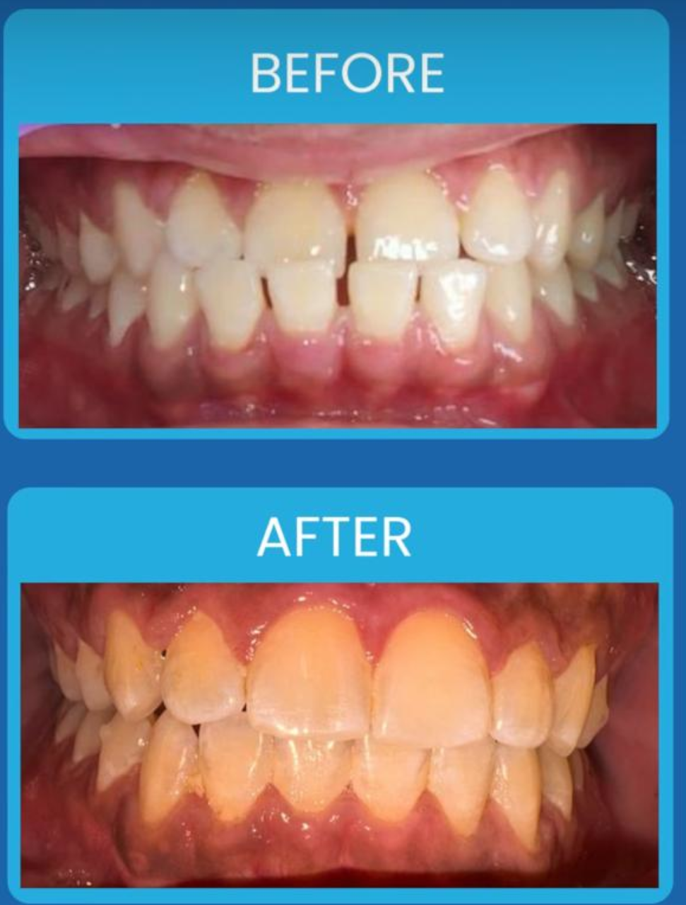 Smile transformation gallery image