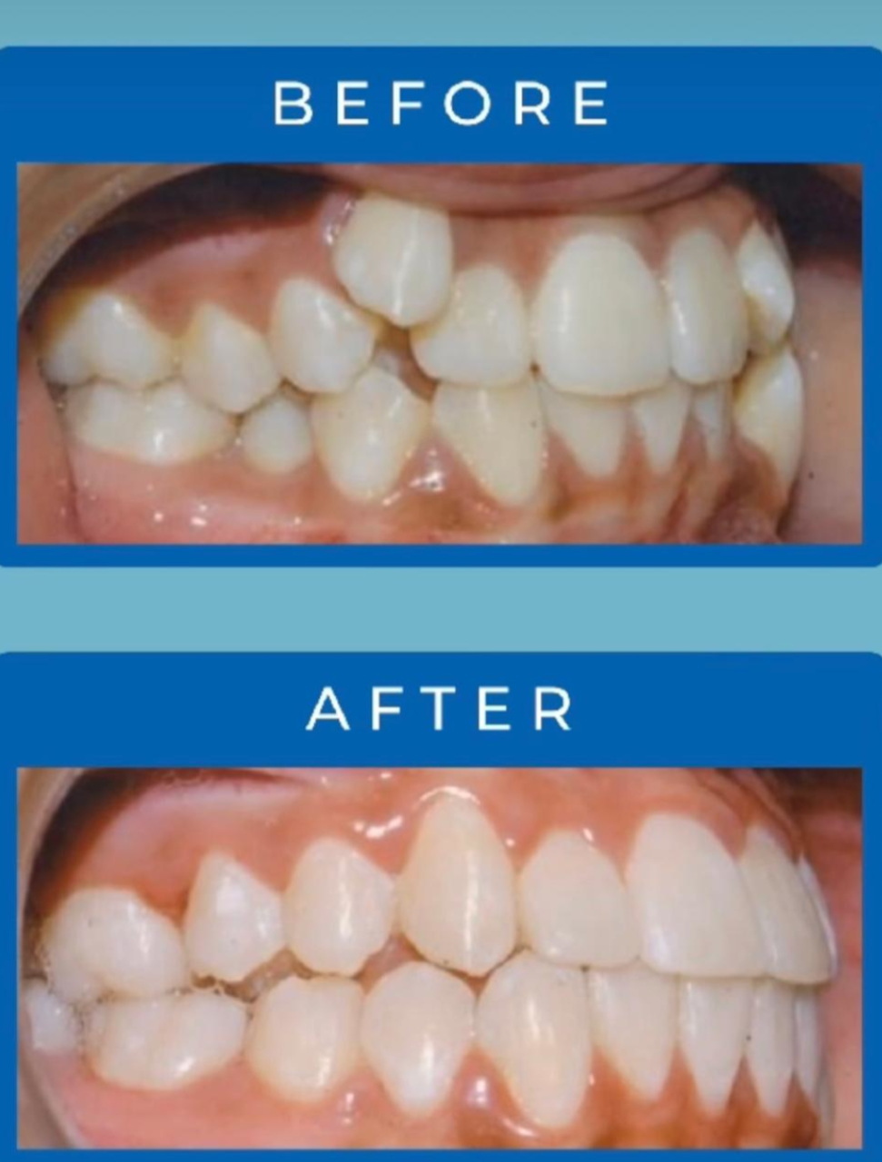 Patient smile transformation story