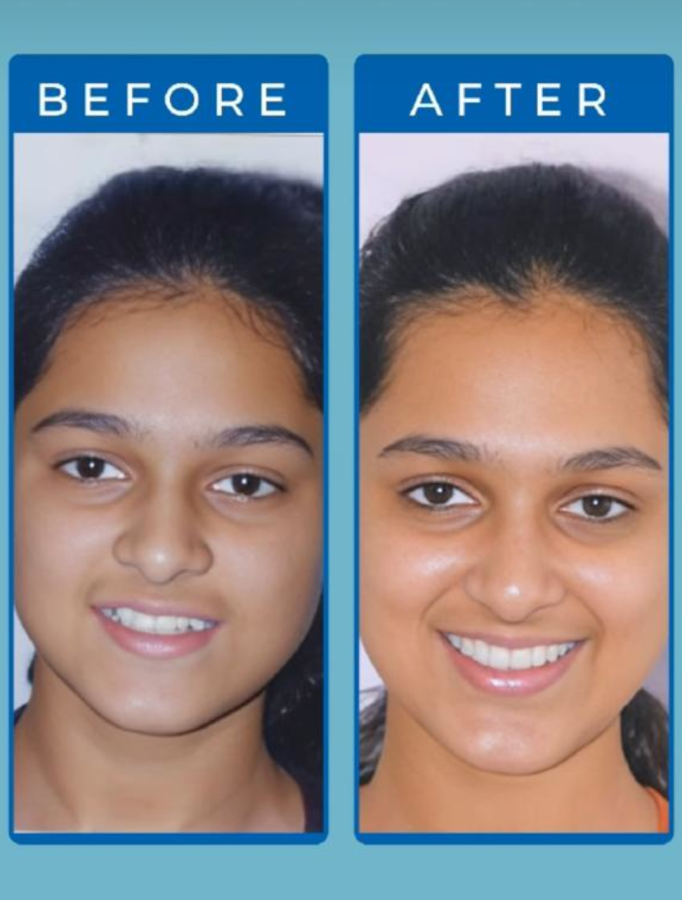 Orthodontic treatment success