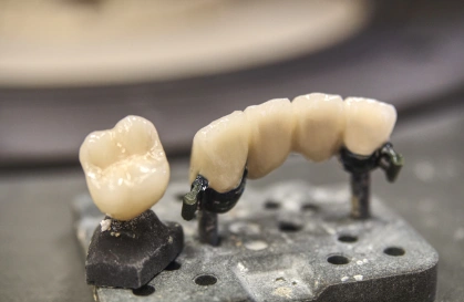 Porcelain and zirconia restorations in Bellandur