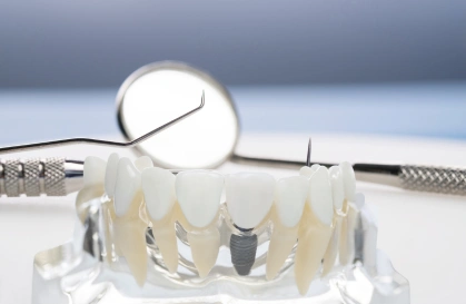 Dental crowns in Bellandur