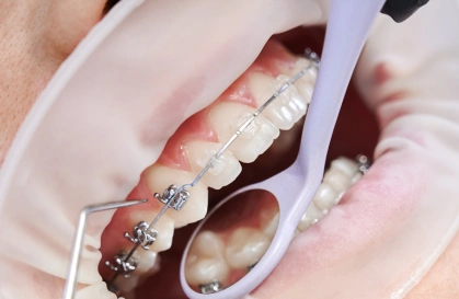 ortho 2