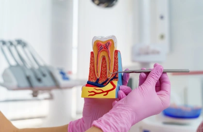 root canal 1