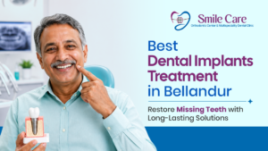 Best Dental Implants Treatment in Bellandur